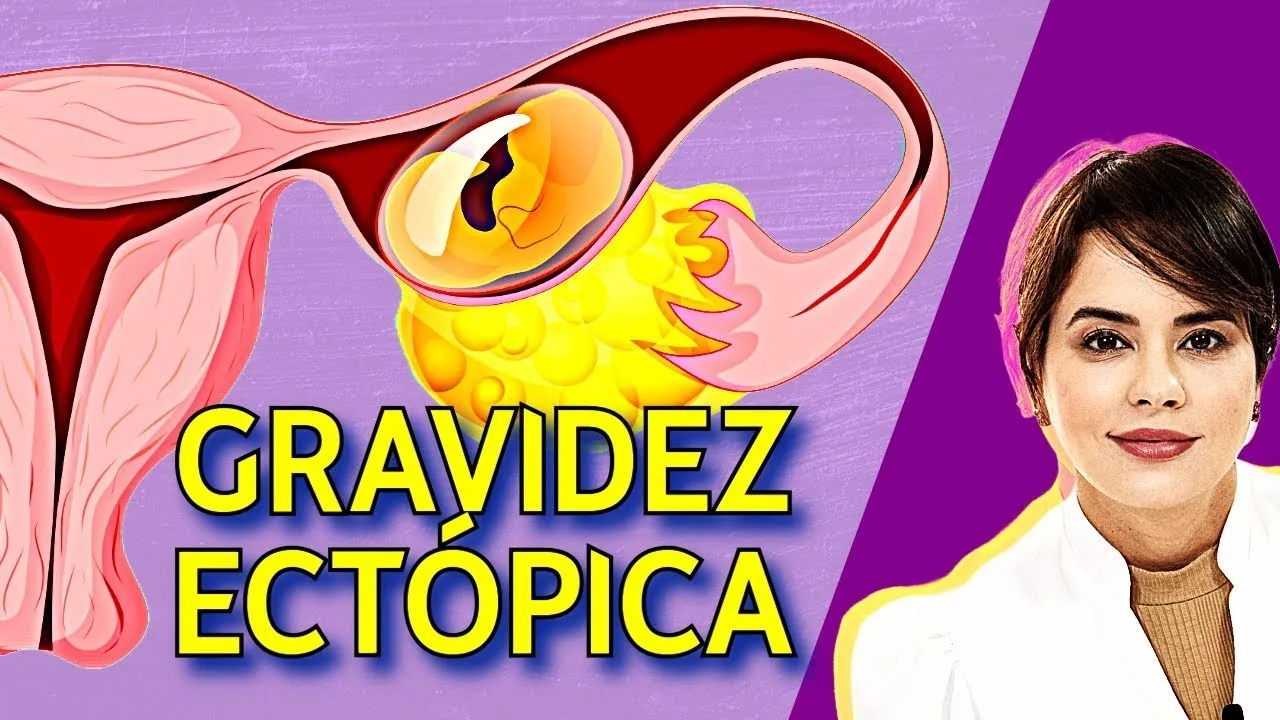 Gravidez Ectópica: sinais, riscos e soluções para um perigo silencioso