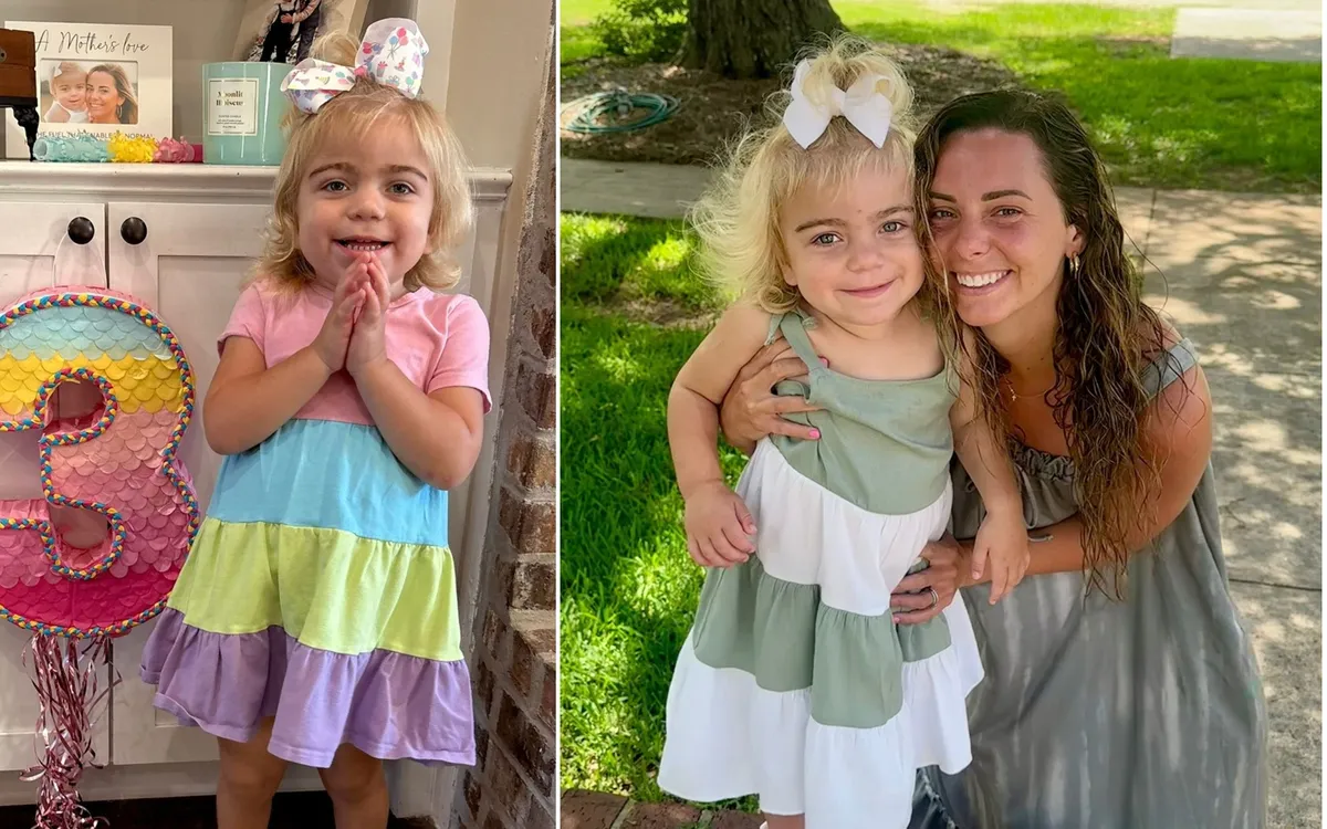 Síndrome de Sanfilippo: caso de menina de 3 anos mostra como sobrancelhas espessas podem indicar Alzheimer infantil - Imagem do artigo