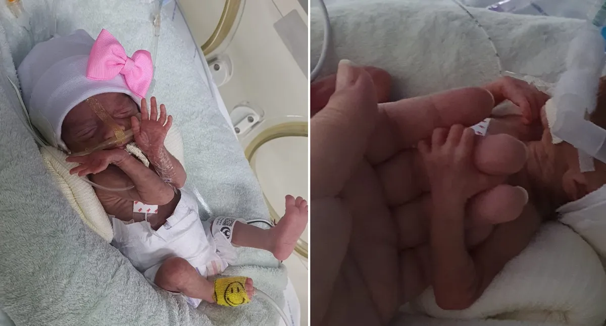 Gêmeos nascem com 28 semanas em Suzano e enfrentam 92 dias de UTI até a plena recuperação - Imagem do artigo