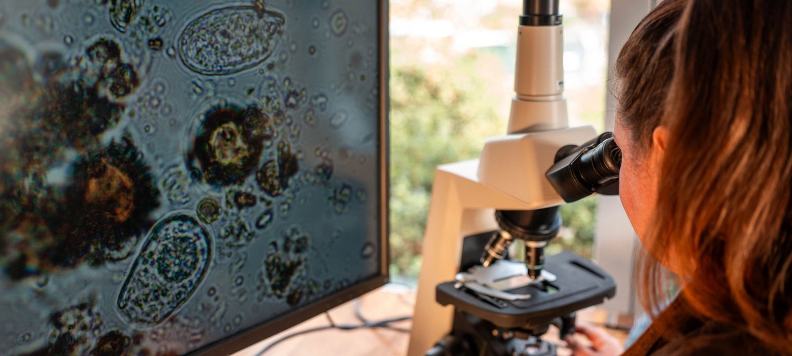 Ameba comedora de cérebro: expansão global acende alerta sobre riscos e prevenção - Imagem do artigo