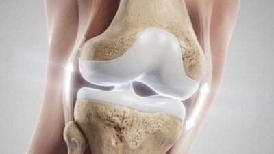 Injeção para o joelho revoluciona tratamento ao recuperar cartilagem e frear artrite sem cirurgia